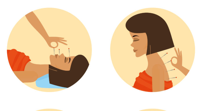 Agopuntura: l’efficienza della medicina naturale Agopuntura