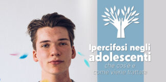 Ipercifosi negli adolescenti: che cos’è e come viene trattata ipercifosi