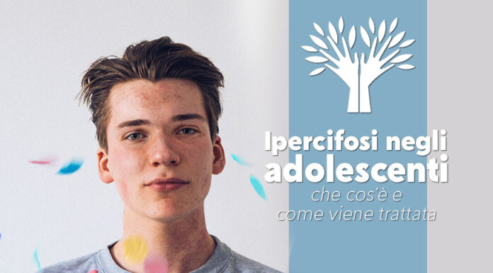 Ipercifosi negli adolescenti: che cos’è e come viene trattata ipercifosi